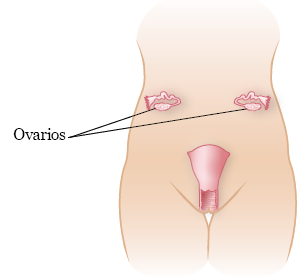 Figura 2. Ubicación de los ovarios después de la cirugía de trasposición ovárica