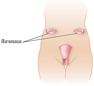 Рисунок 2.  Расположение яичников после операции по транспозиции