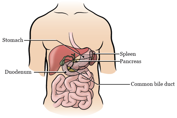 图 2. 将在手术期间被切除的器官