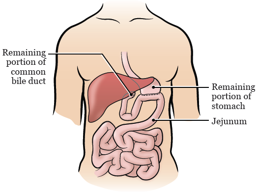 图 3. 腹部（手术后）