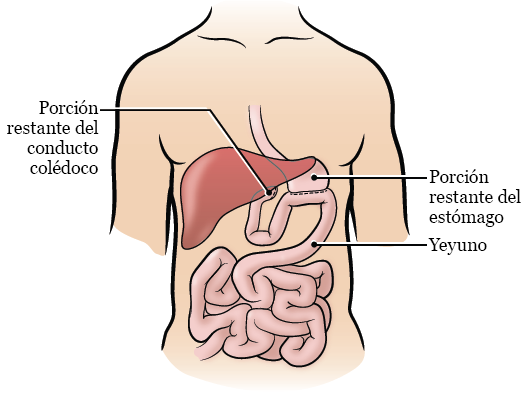 Figura 3. El abdomen después de la cirugía