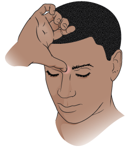 "Figure 2. Placing thumb between eyebrows"