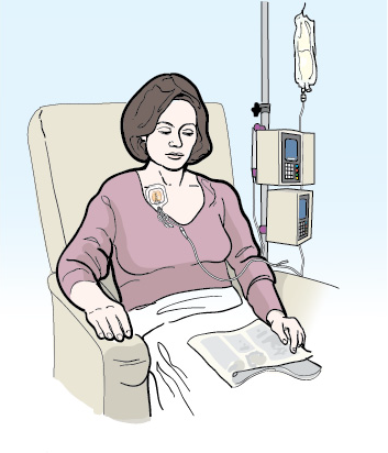 Figure 4. Getting chemotherapy through your tunneled catheter