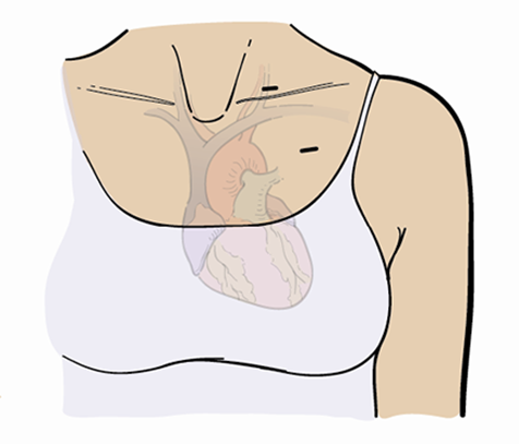 图 2. 静脉和心脏
