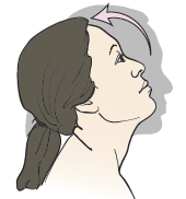 Figura 10. Incline la cabeza hacia atrás