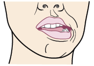 Figure 5. Move your jaw to the left