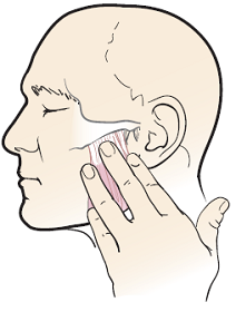 Figura 3. Cómo masajear los músculos de la mandíbula