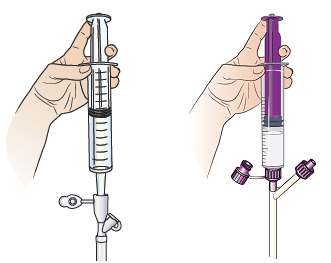 图 9. 将注射器放入带传统接头（左）或 ENFit（右）的饲管