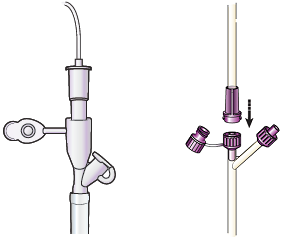 图 11. 将管饲袋的管路与带传统接头（左）和 ENFit（右）的饲管连接