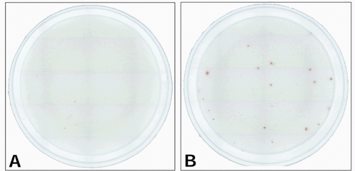 T-cell repertoire measured by ELISPOT assay before (A) and after (B) vaccination with tyrosine peptide and adjuvant.