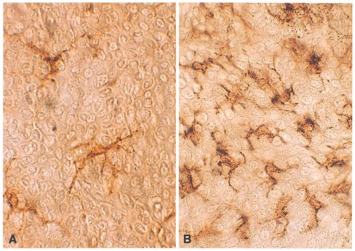 Recruitment of dendritic cells into epidermis by injection of DNA encoding the cytokine GM-CSF