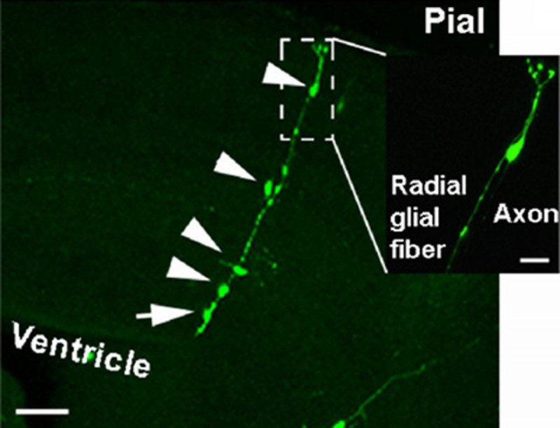 In Utero Retroviral Infection