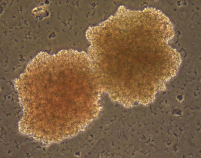 Figure 1: Human erythroid 