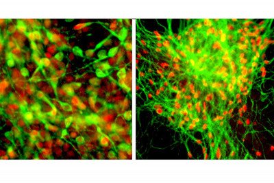Midbrain Dopamine and Spinal Motoneurons from human ES cells