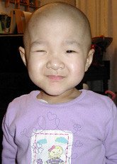 Emily after the stem cell transplant