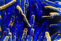 Pictured: Clostridium difficile