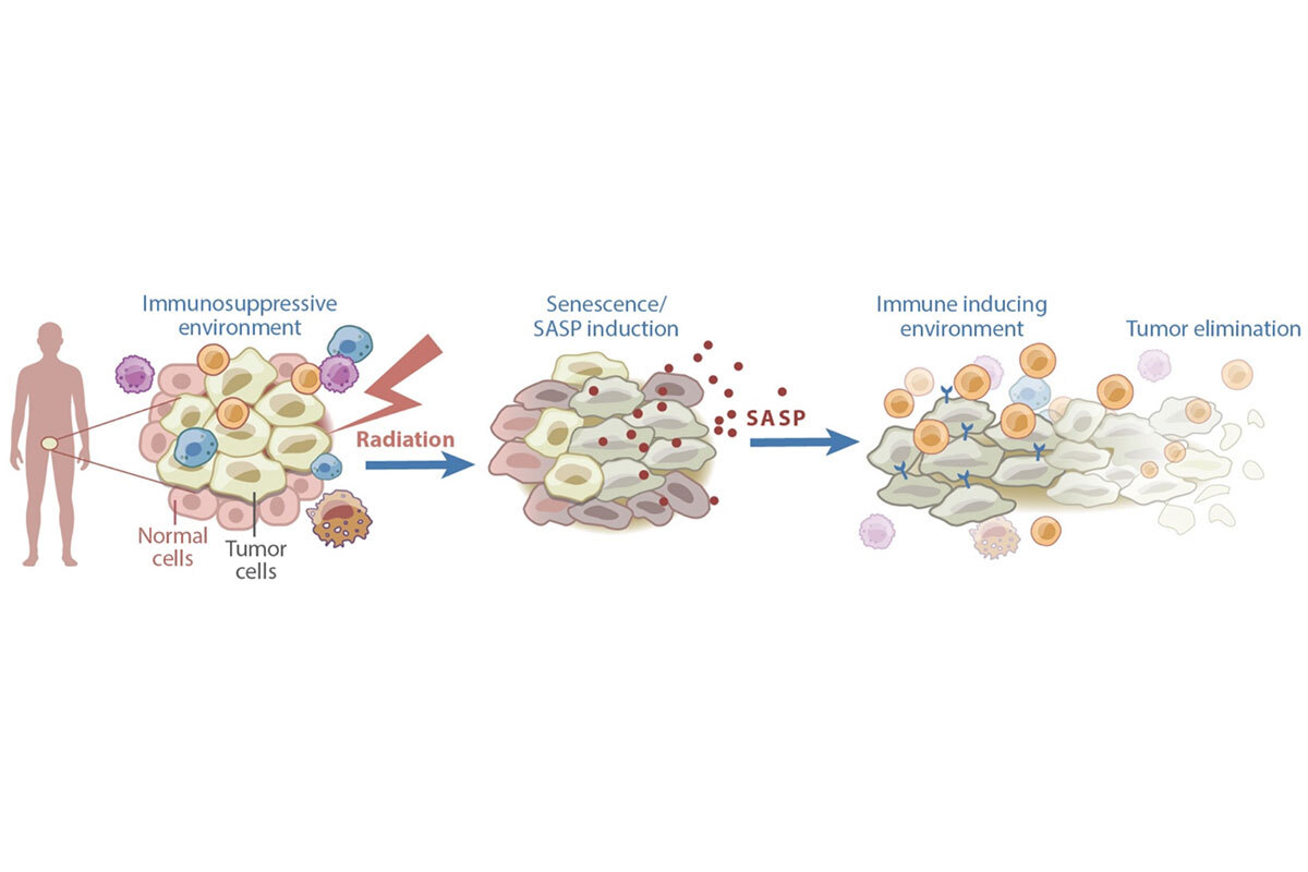 Figure 1. Senescence can contribute to anti-cancer effects of therapy. Certain cancer treatments, including radiation therapy, can induce senescence and the SASP. The SASP subsequently remodels the tumor microenvironment in a manner that induces immune surveillance of the tumor.