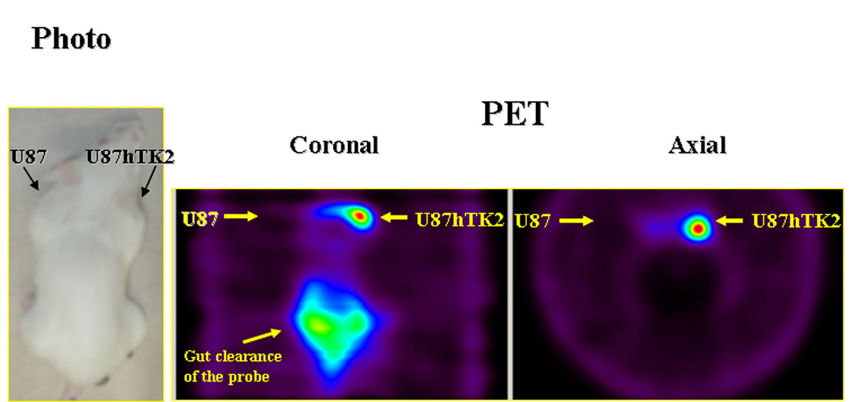 In vivo PET imaging of hƒ´TK2 expression in transduced and wild-type U87 xenografts in mice at 2 hours after [124I]FIAU administration.
