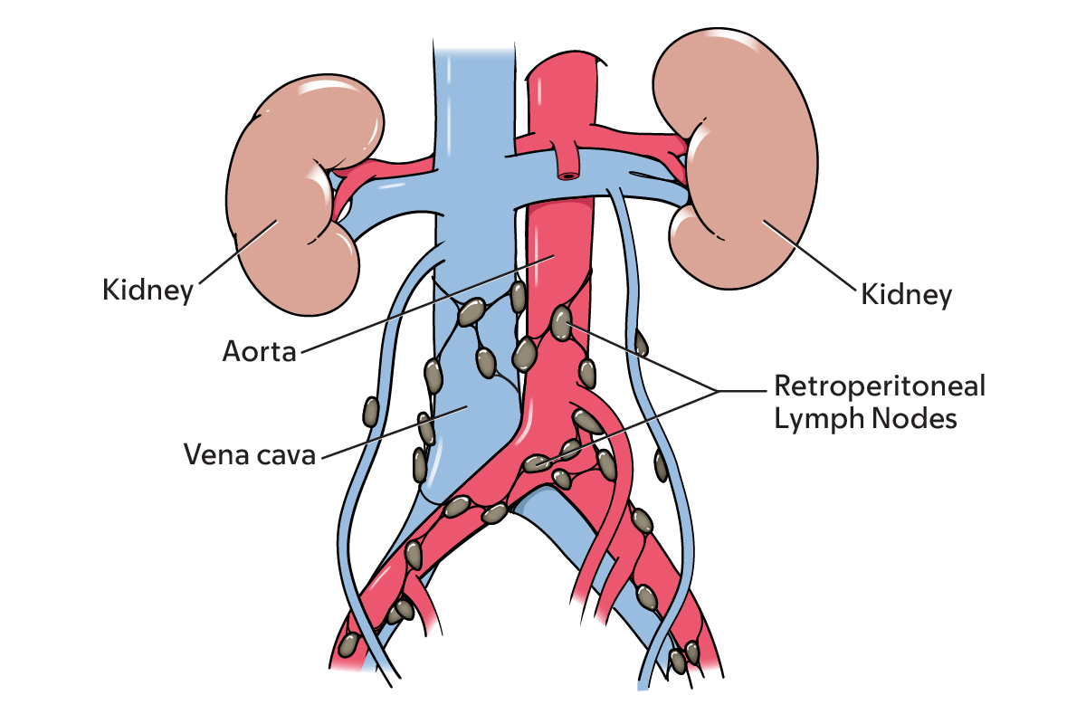 The retroperitoneal lymph nodes