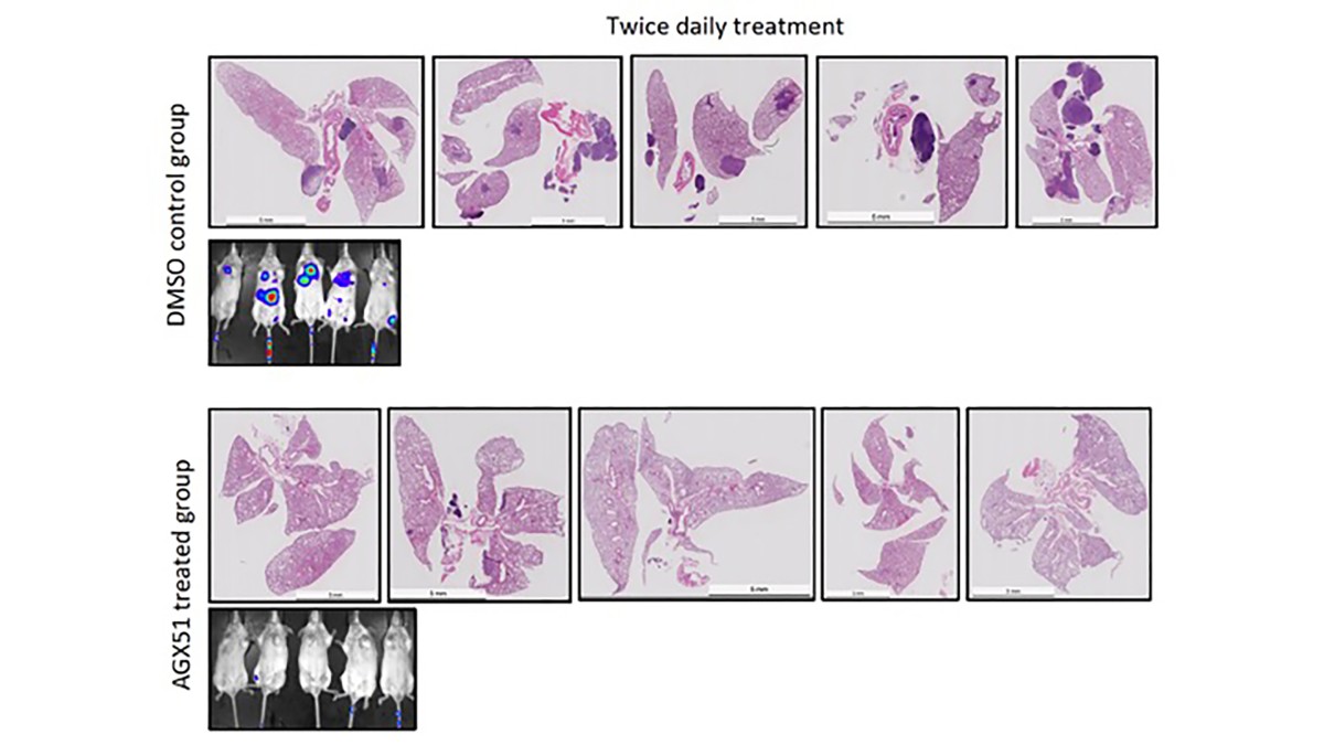 Inhibition of metastasis by AGX51, an Id degrader