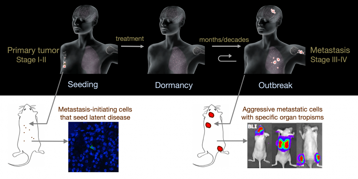 Stages of metastasis and mouse models for their analysis