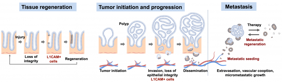 L1CAM defines the regenerative origin of metastasis initiating cells (from Ganesh et al Nature Cancer 2020).