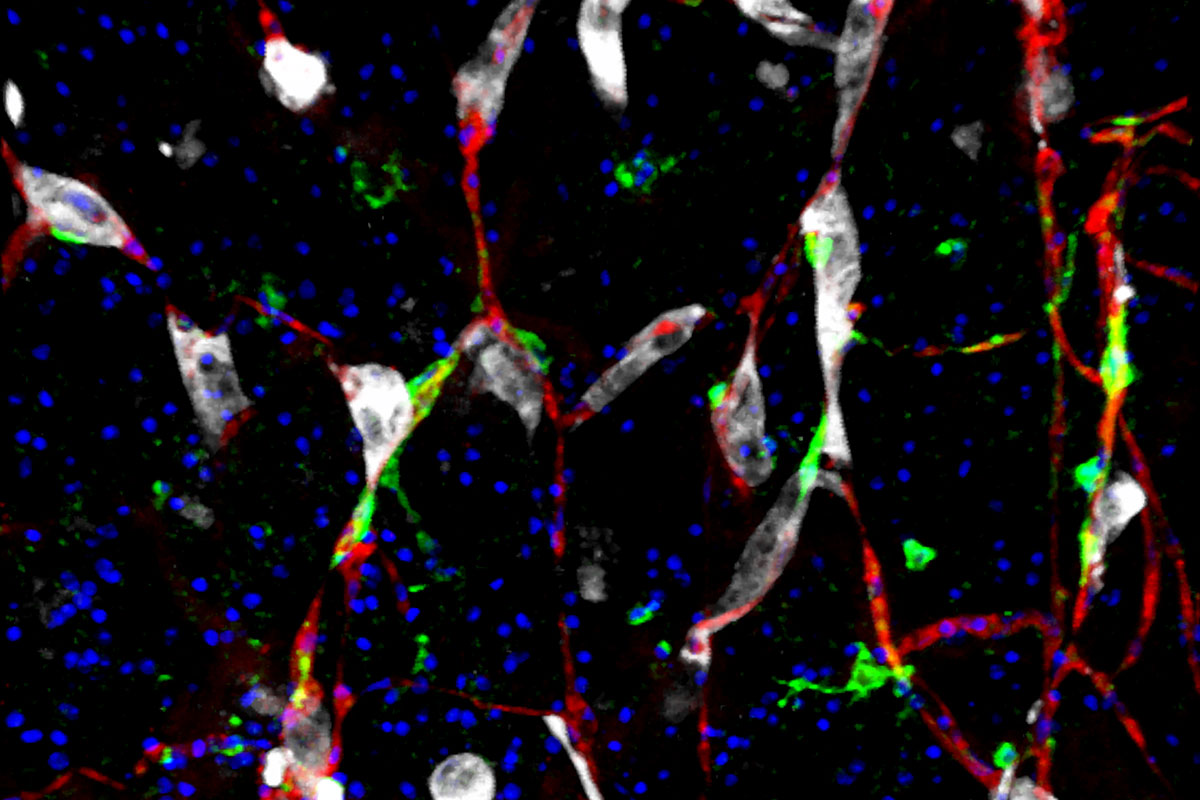 This image shows cancer cells (white) and pericytes (green) clinging to capillaries (red). The blue dots are nuclei. 