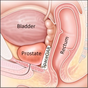 sharp advantage prostate