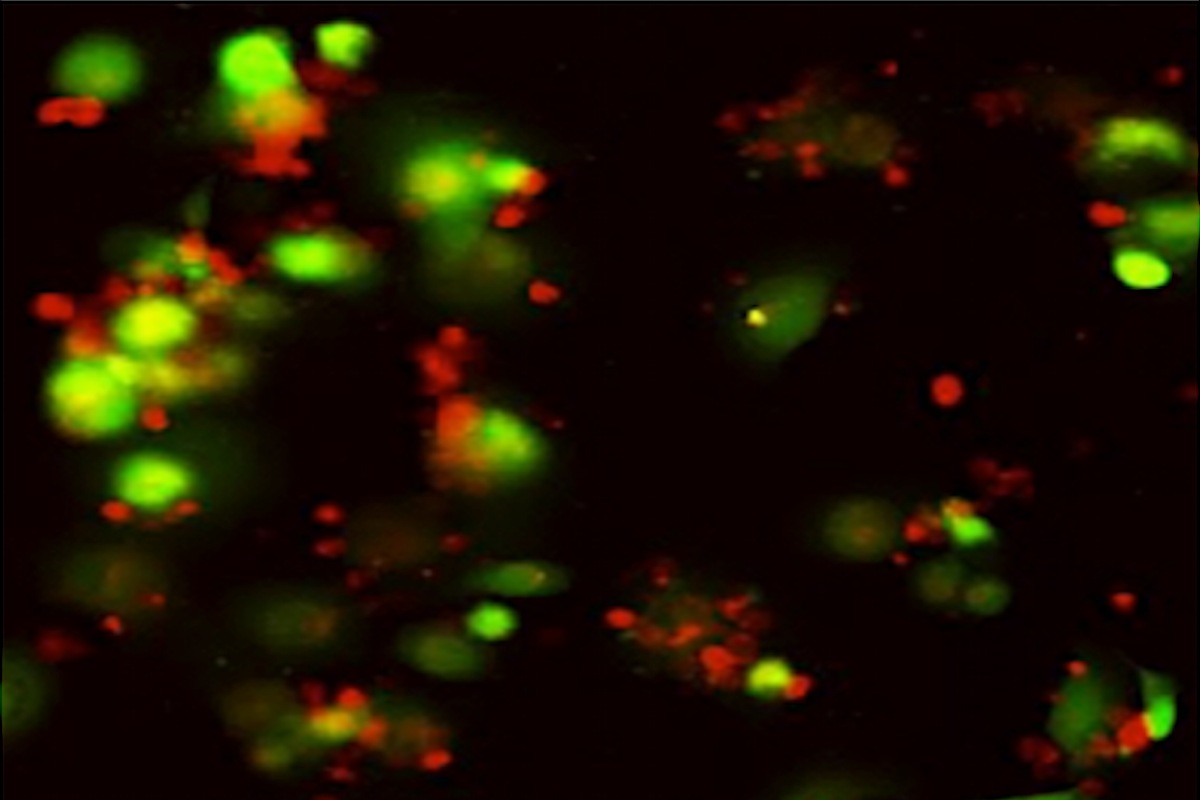 NK cells (red) attach to and kill senescent lung tumor cells (green) 