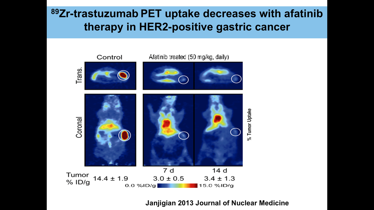 Zr-trastuzumab PET uptake decreases with afatinib therapy in HER2-positive gastric cancer