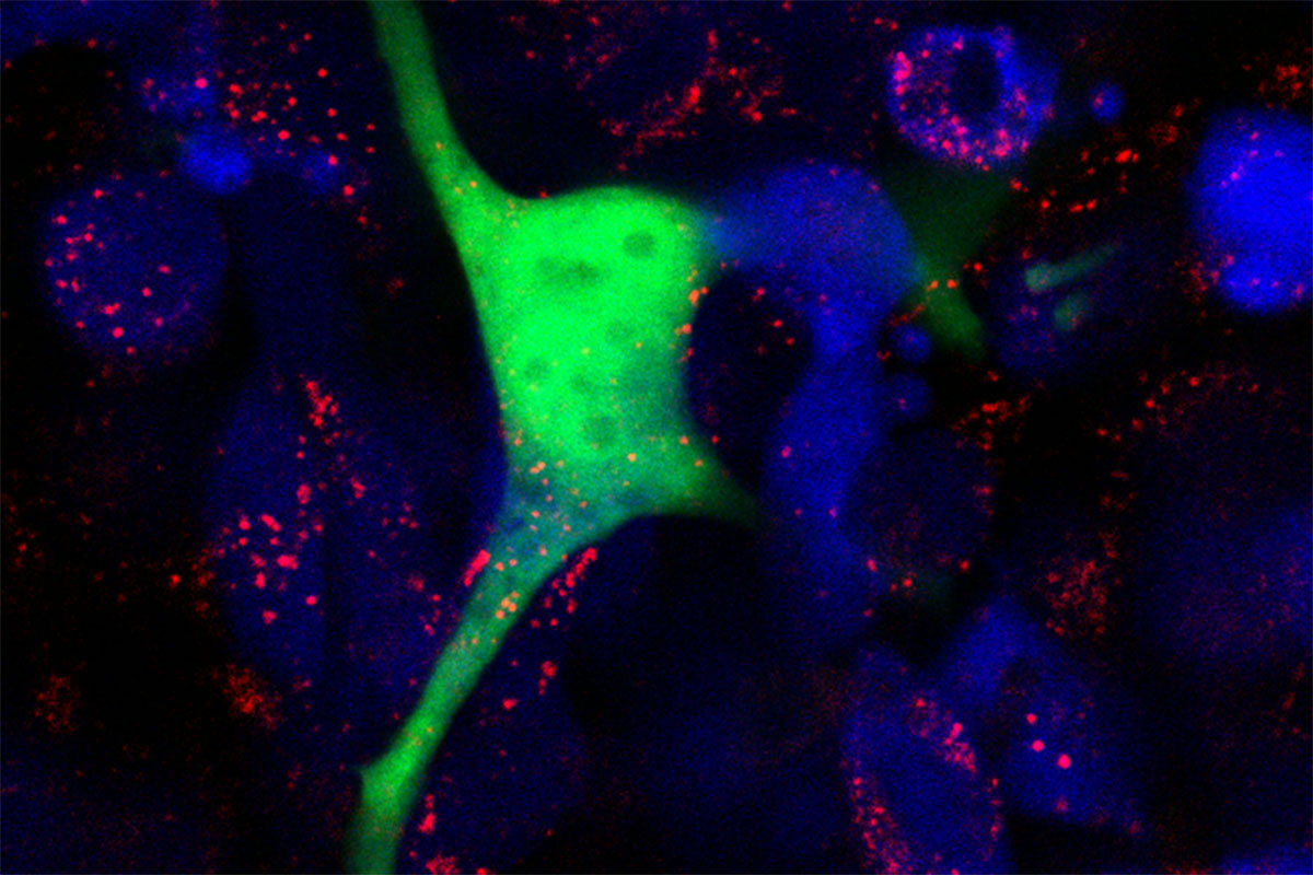 This fluorescent microscopy image shows melanoma cells (blue) secreting vesicles (red), which are taken up by the adjacent keratinocyte cell (green).