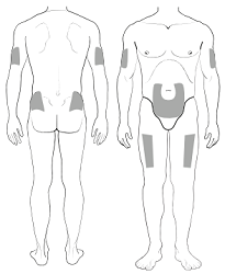 Giving Yourself an Injection of Filgrastim (NeupogenÂ®) or