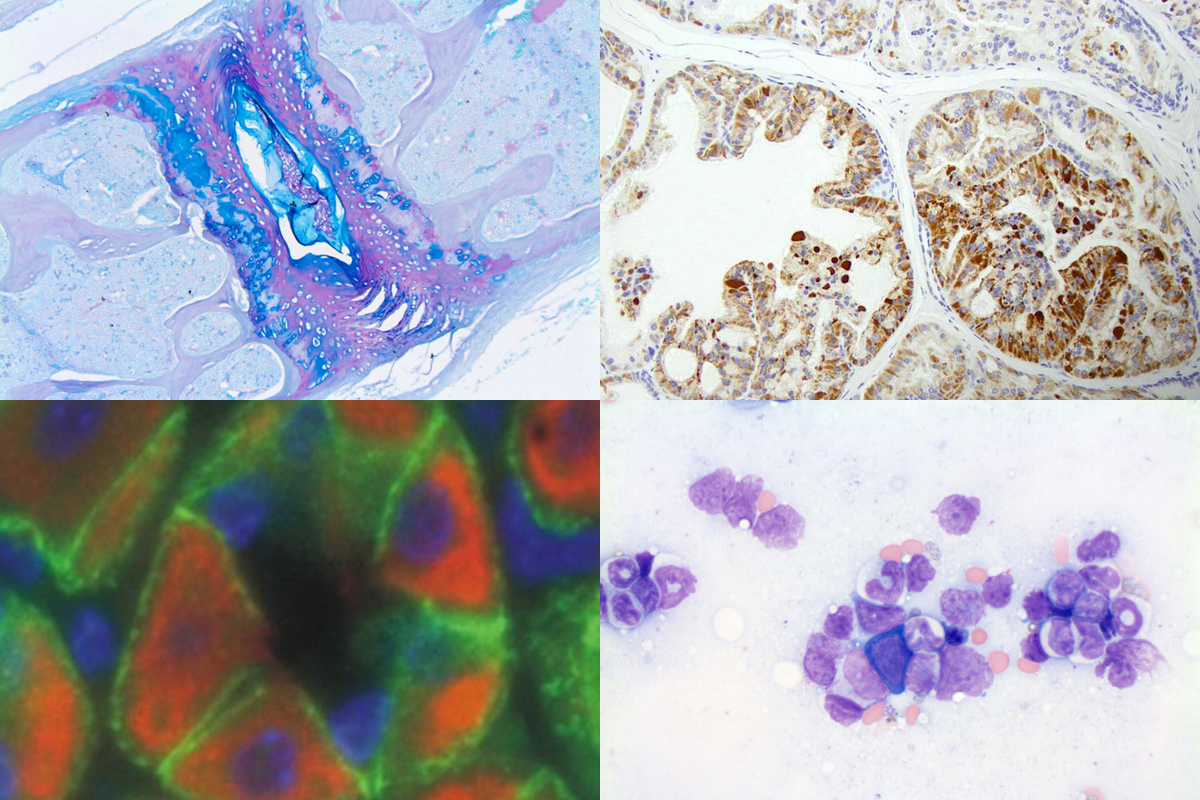 Alcian blue/PAS and IHC; Bottom row, from left: IF and Wright-Giemsa