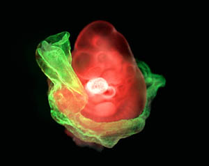 Mouse embryo expressing a red fluorescent protein (RFP) reporter. Extra-embryonic tissues which are essential for normal embryo develoment express a green fluorescent protein (GFP) reporter.