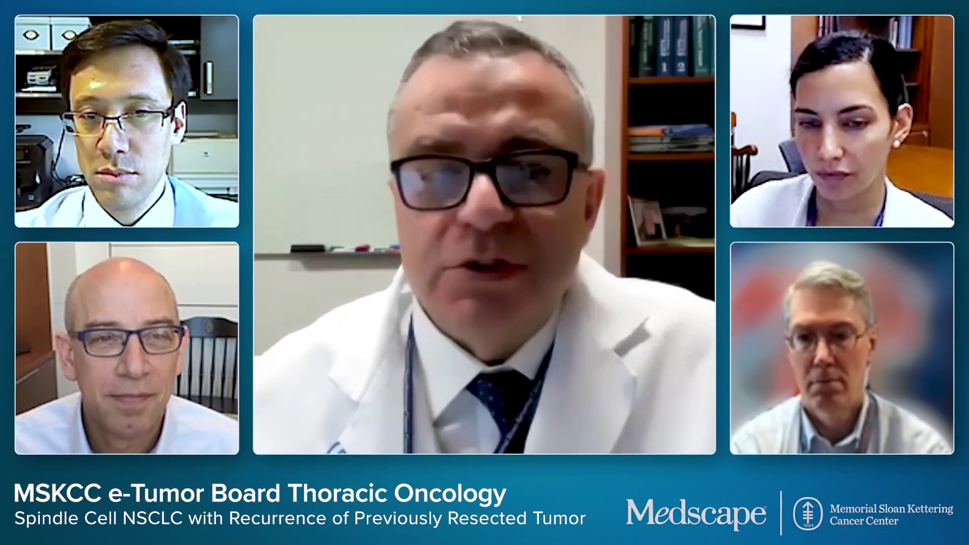 MSK e-Tumor Board: Spindle Cell NSCLC with Recurrence of Previously Resected Tumor