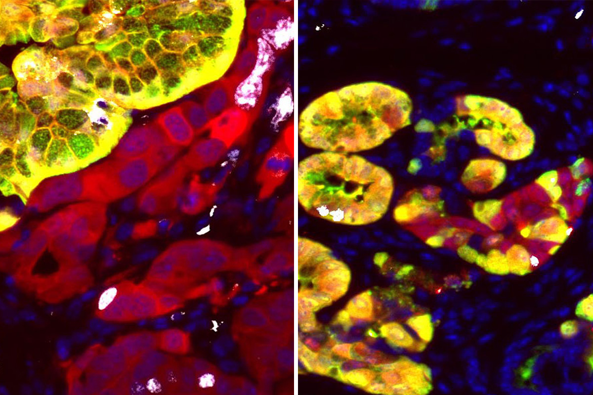 Two images of stained cells side by side