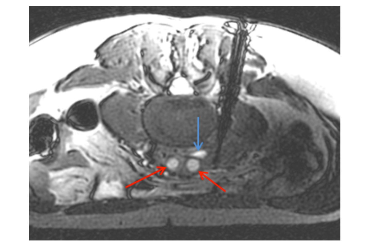 Superior soft tissue resolution of MRI.