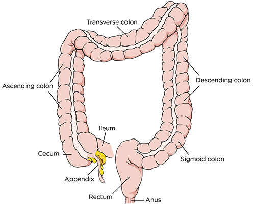 Colon Resection Soft Diet