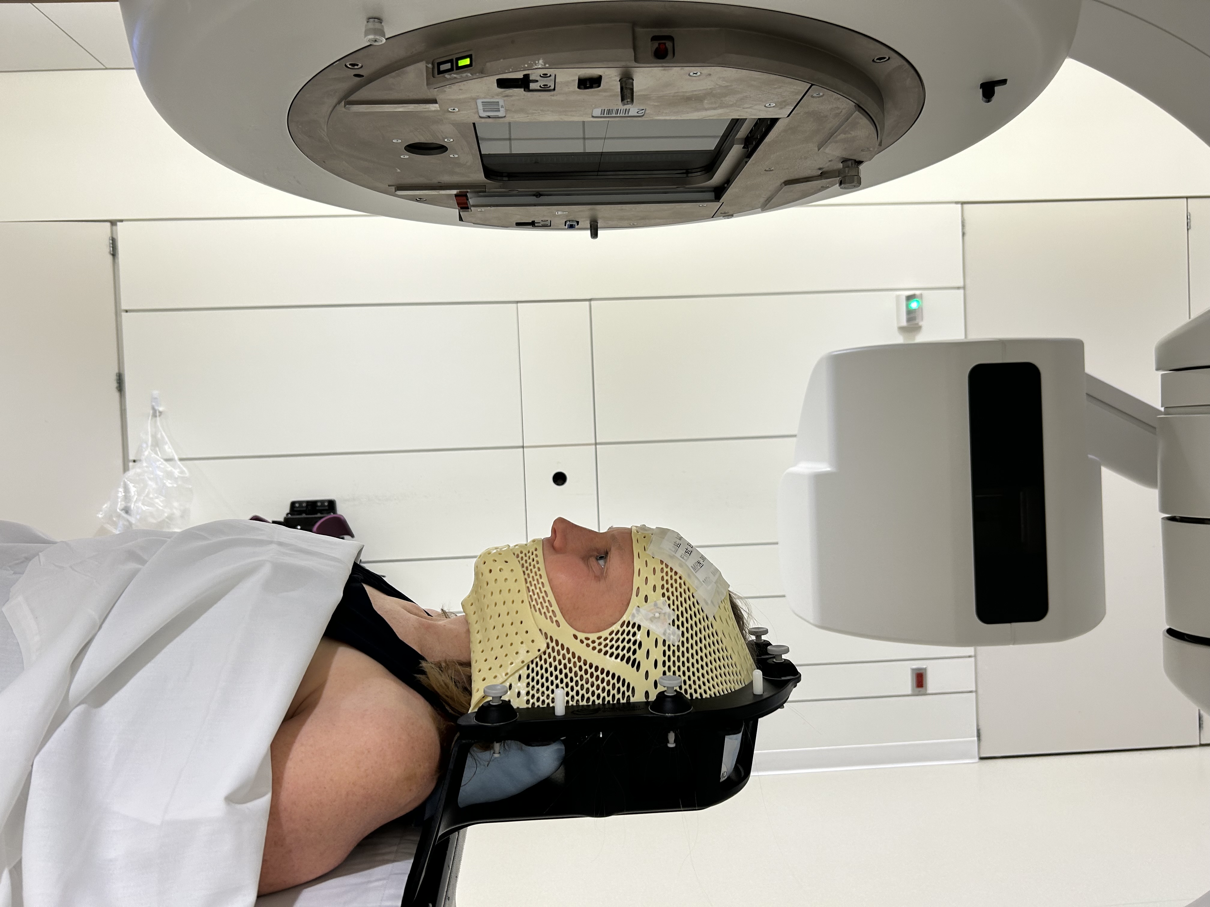 Patient receiving radiation treatment to head.