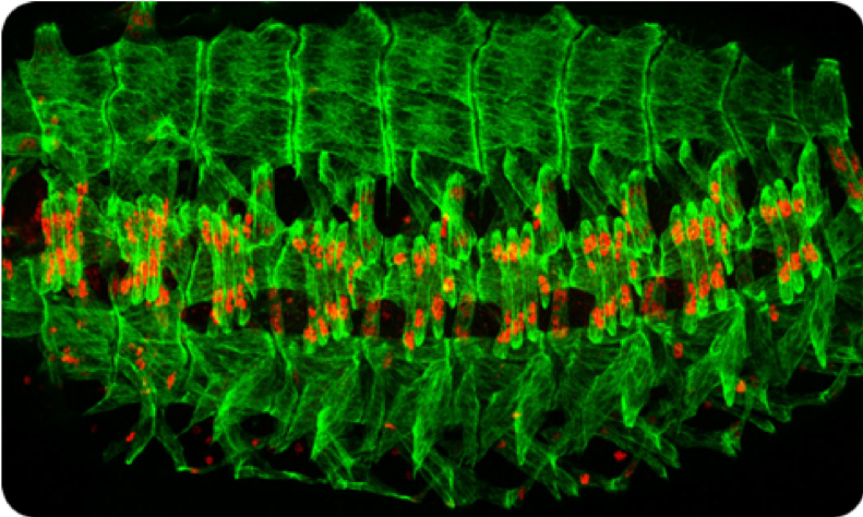 Image showing a late stage Drosophila embryo in which the individual muscle cells (green) are visualized.