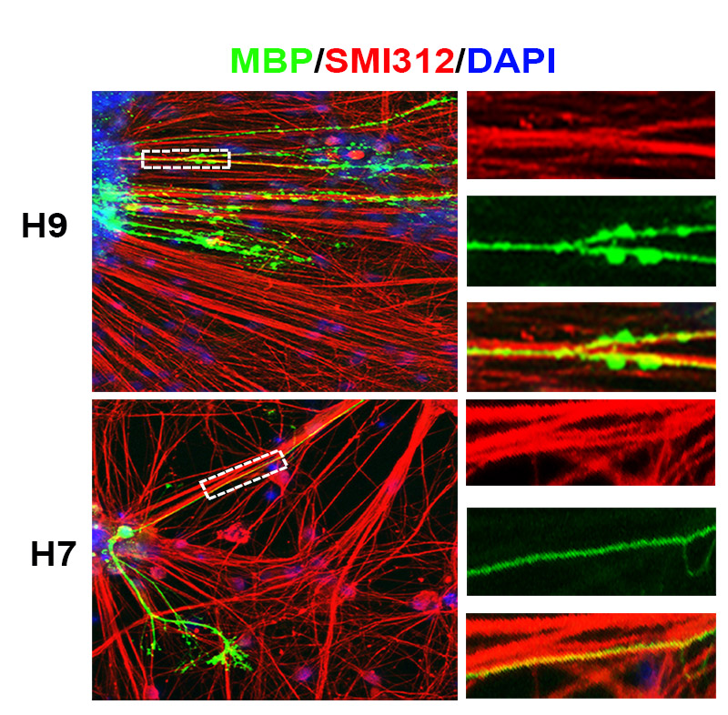 Human ES derived oligoprogenitors (green) myelinate axons in vitro