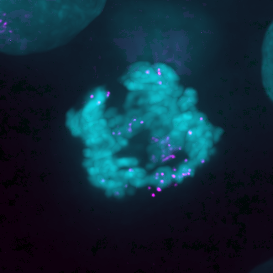 Fluorescence microscopy image of a mitotic cell with chromosomes labelled in cyan and ecDNA foci in magenta