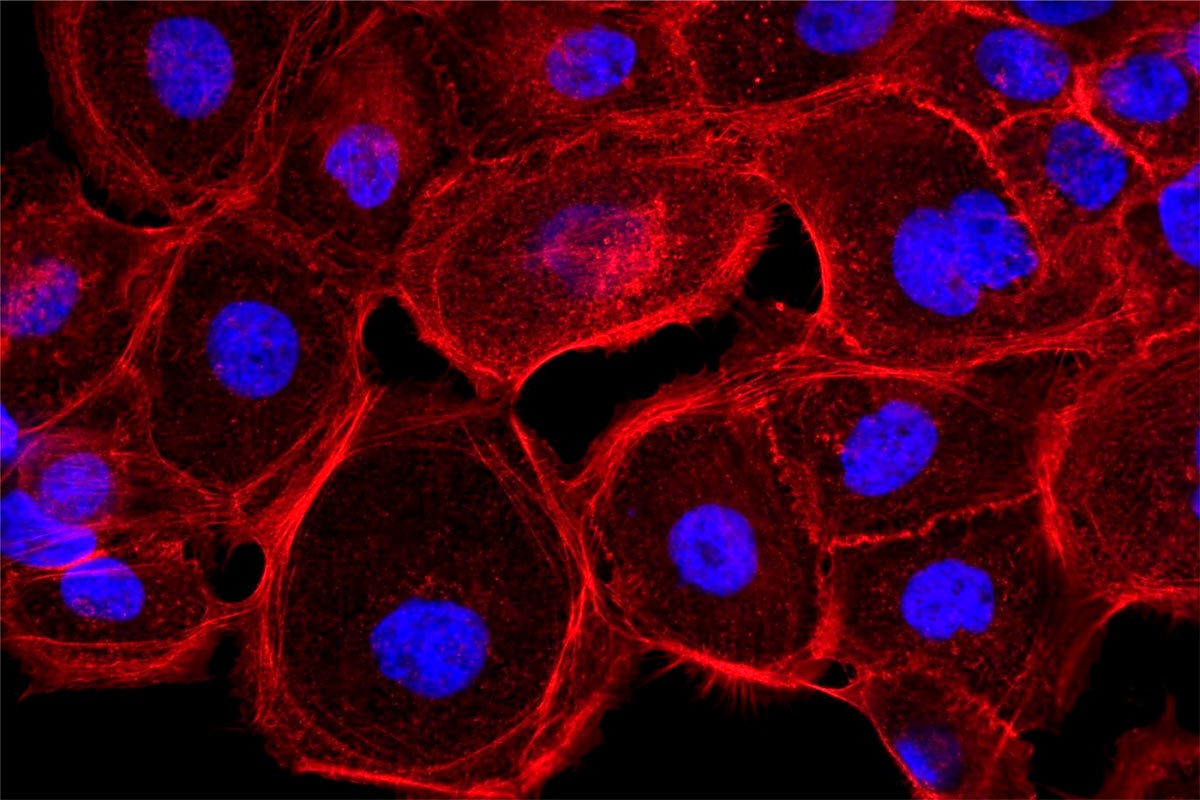 The Powell lab researches how normal cells become cancerous by studying how genome integrity is maintained.