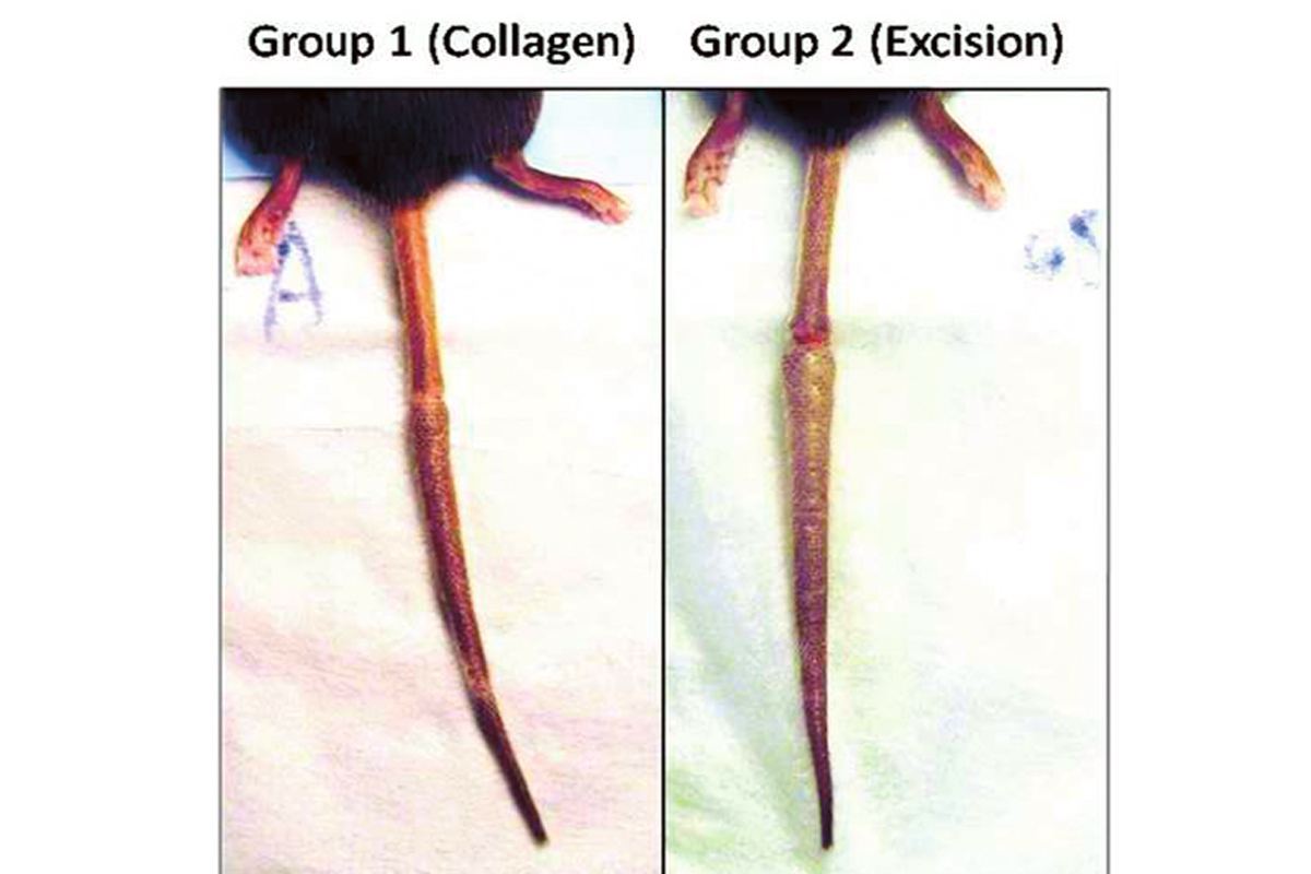Acute lymphedema induced in the tails of mice.