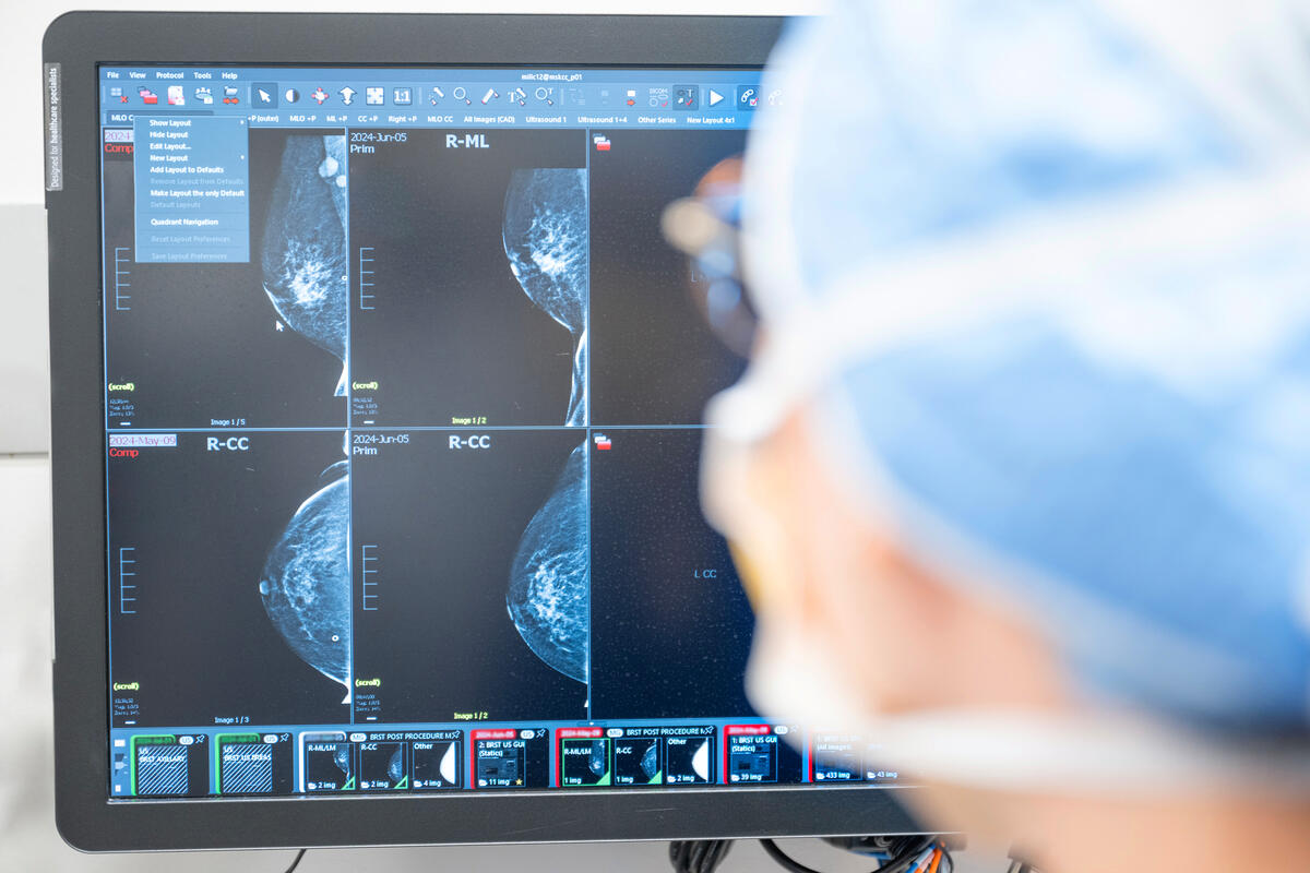 Physician looking at breast imaging