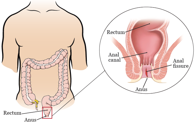 Anal treatment