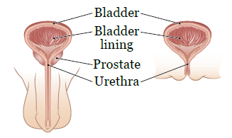 Figure 1. Your bladder and urothelium