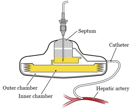 Figure 1. Parts of your pump