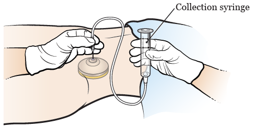 图 3. 针头、注射管和注射器