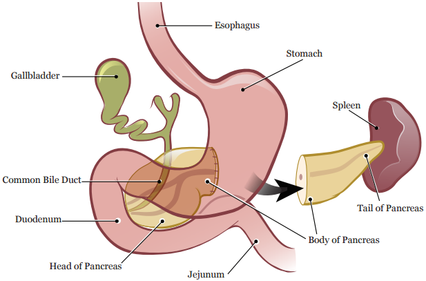 Figure 2. Your pancreas after your distal pancreatectomy